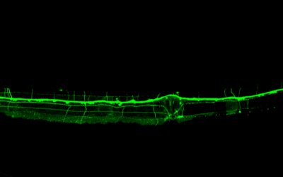 Un estudio del CSIC observa un mecanismo inédito en la formación de las neuronas sensoriales