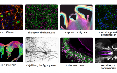 L’Institut de Neurociències dóna a conéixer els guanyadors del seu I Concurs de Fotografia Científica