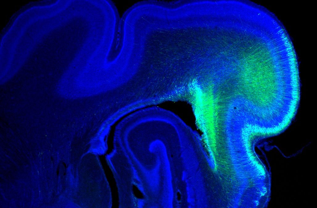 El CSIC desvela la implicación evolutiva de un pequeño ARN en el tamaño de la corteza cerebral humana