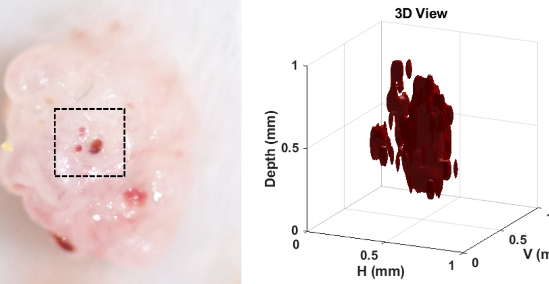 El I3M obtiene las primeras imágenes en 3D de un melanoma en ratones con un microscopio fotoacústico de bajo coste