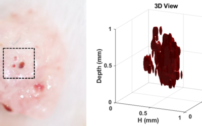 El I3M obtiene las primeras imágenes en 3D de un melanoma en ratones con un microscopio fotoacústico de bajo coste