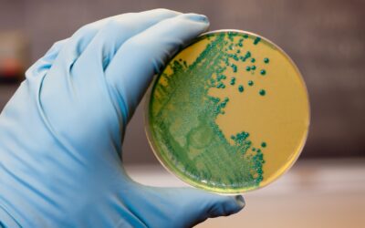 El CSIC patenta un nuevo método más eficaz, sostenible y seguro para combatir la listeria