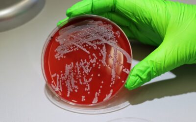 Un equipo del CSIC analiza por primera vez a gran escala cómo se adapta la bacteria del estafilococo en humanos